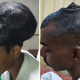 Fases del tumor cerebral de Santlal Pal. Nair Hospital
